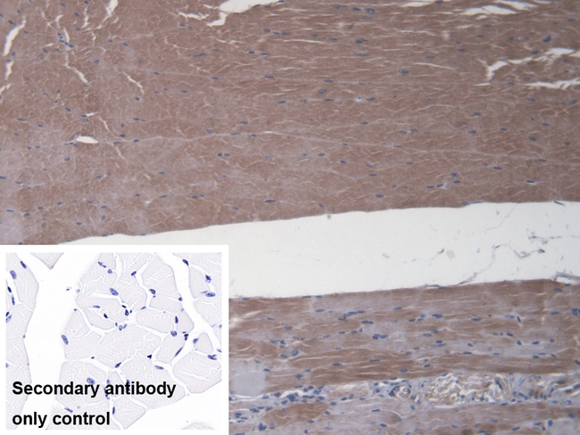 FPGS Antibody in Immunohistochemistry (Paraffin) (IHC (P))