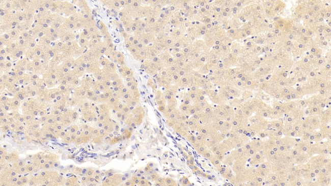 NOTCH2 Antibody in Immunohistochemistry (Paraffin) (IHC (P))