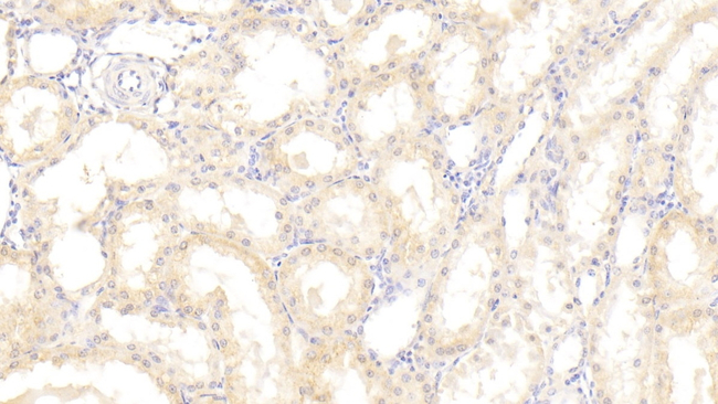DKK4 Antibody in Immunohistochemistry (Paraffin) (IHC (P))