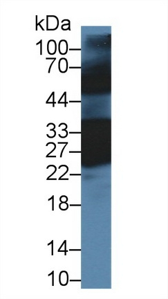 CRYBB1 Antibody in Western Blot (WB)