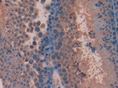 PACAP-38 Antibody in Immunohistochemistry (Paraffin) (IHC (P))