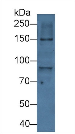 ITIH2 Antibody in Western Blot (WB)