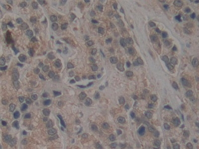 TEP1 Antibody in Immunohistochemistry (Paraffin) (IHC (P))