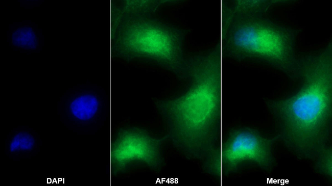 Complement C5a Antibody in Immunocytochemistry (ICC/IF)