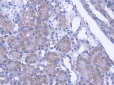 PTPN21 Antibody in Immunohistochemistry (Paraffin) (IHC (P))