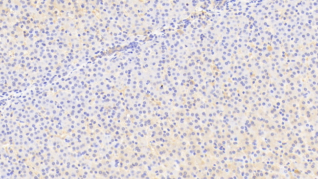 SLC25A37 Antibody in Immunohistochemistry (Paraffin) (IHC (P))