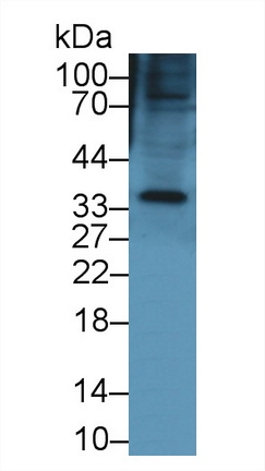Keratocan Antibody in Western Blot (WB)
