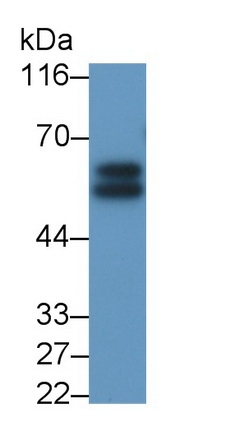 IL6R Antibody in Western Blot (WB)