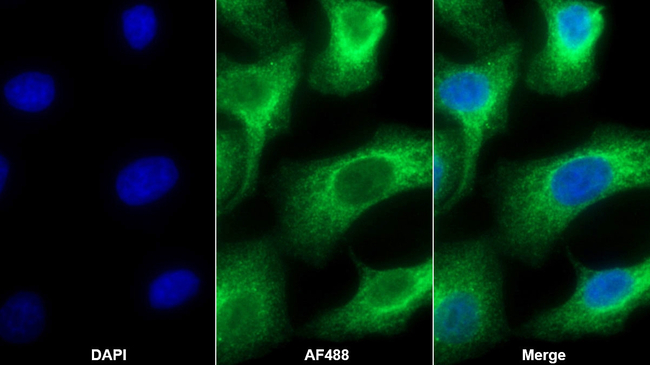 RARS Antibody in Immunocytochemistry (ICC/IF)