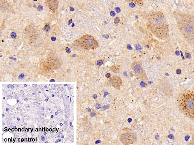 Cathepsin L Antibody in Immunohistochemistry (Paraffin) (IHC (P))