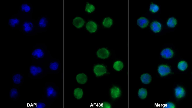 BAFF Receptor (CD268) Antibody in Immunocytochemistry (ICC/IF)
