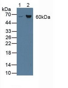 Asparagine Synthetase Antibody in Western Blot (WB)