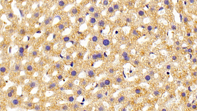 PLCE1 Antibody in Immunohistochemistry (Paraffin) (IHC (P))