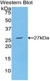 WISP2 Antibody in Western Blot (WB)