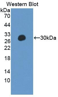PTPN14 Antibody in Western Blot (WB)