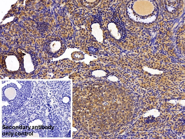 Thioredoxin 1 Antibody in Immunohistochemistry (Paraffin) (IHC (P))