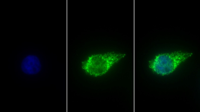 ALDH1B1 Antibody in Immunocytochemistry (ICC/IF)