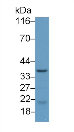 CHRNE Antibody in Western Blot (WB)