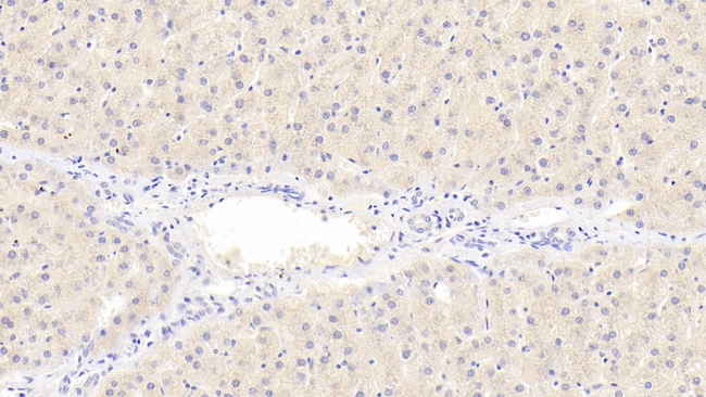 COQ10B Antibody in Immunohistochemistry (Paraffin) (IHC (P))