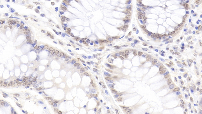 ZNF384 Antibody in Immunohistochemistry (Paraffin) (IHC (P))