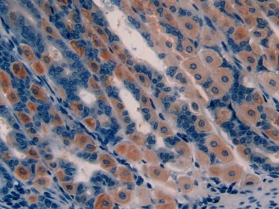 GHRH Antibody in Immunohistochemistry (Paraffin) (IHC (P))