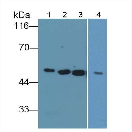 alpha Amylase 1 Antibody in Western Blot (WB)