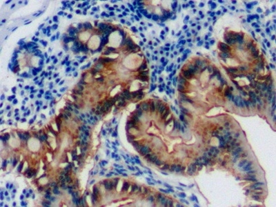 Galectin 3 Antibody in Immunohistochemistry (Paraffin) (IHC (P))