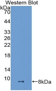 ADAMTS8 Antibody in Western Blot (WB)