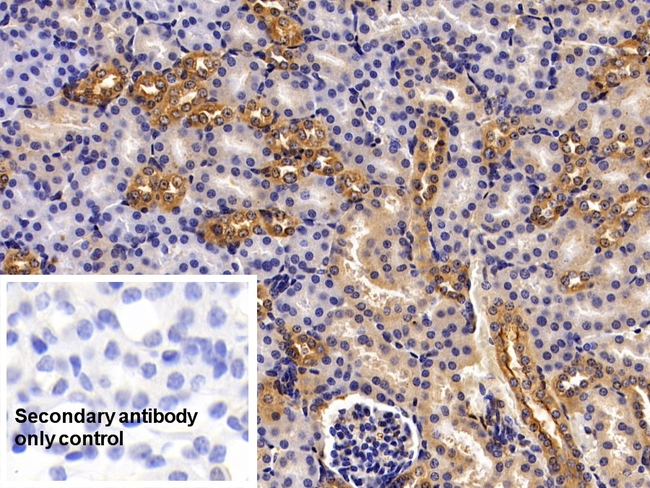 Annexin A6 Antibody in Immunohistochemistry (Paraffin) (IHC (P))
