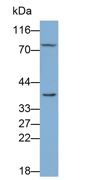 KIR2DL1 Antibody in Western Blot (WB)
