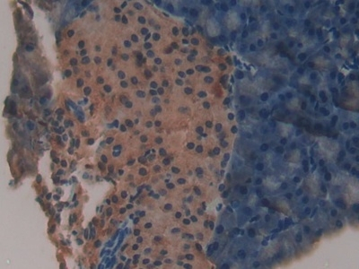 NDUFAB1 Antibody in Immunohistochemistry (Paraffin) (IHC (P))