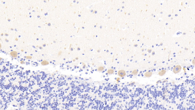 MAN1A1 Antibody in Immunohistochemistry (Paraffin) (IHC (P))