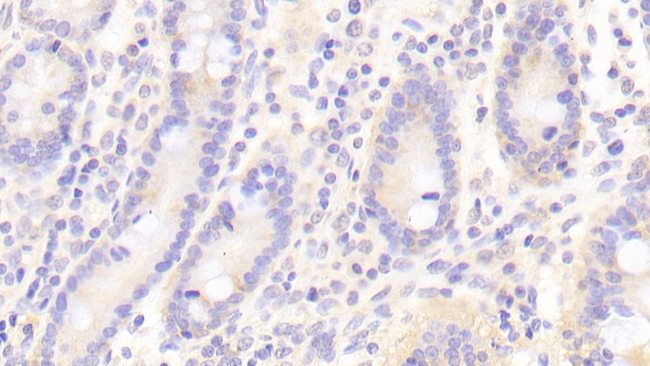 CD16b Antibody in Immunohistochemistry (Paraffin) (IHC (P))