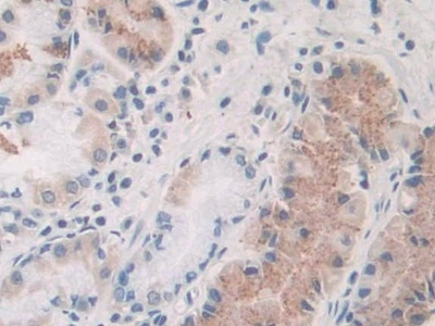PLA2G10 Antibody in Immunohistochemistry (Paraffin) (IHC (P))