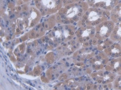SCEL Antibody in Immunohistochemistry (Paraffin) (IHC (P))