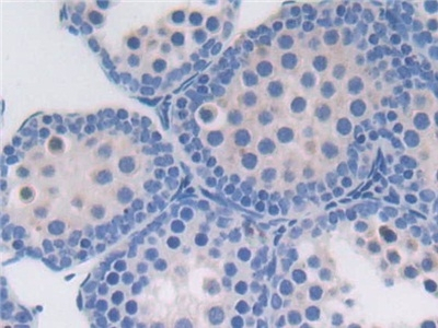 Protein Z Antibody in Immunohistochemistry (Paraffin) (IHC (P))