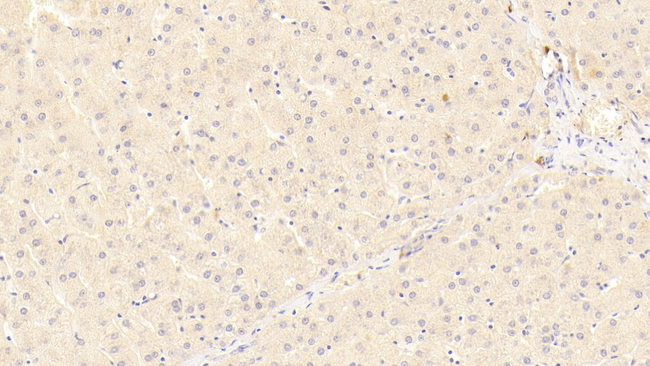 LRP5 Antibody in Immunohistochemistry (Paraffin) (IHC (P))