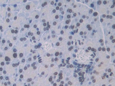Cathepsin C Antibody in Immunohistochemistry (Paraffin) (IHC (P))