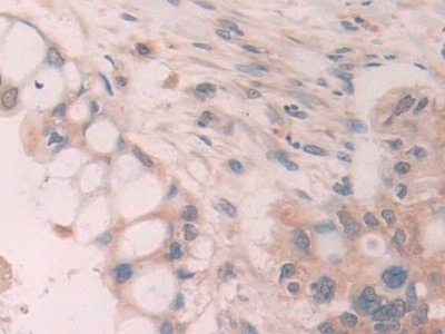 SCUBE3 Antibody in Immunohistochemistry (Paraffin) (IHC (P))