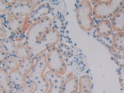 PKP1 Antibody in Immunohistochemistry (Paraffin) (IHC (P))