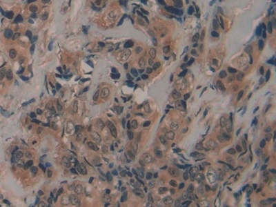 Fibrillin 2 Antibody in Immunohistochemistry (Paraffin) (IHC (P))