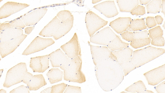 iNOS Antibody in Immunohistochemistry (Paraffin) (IHC (P))