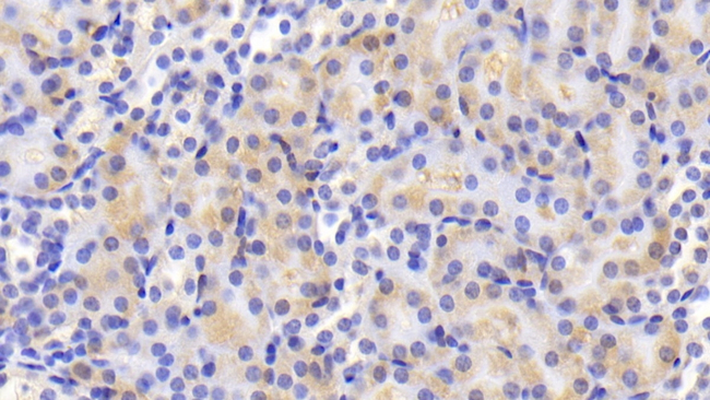 Aconitase 1 Antibody in Immunohistochemistry (Paraffin) (IHC (P))
