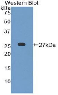 LILRB3 Antibody in Western Blot (WB)
