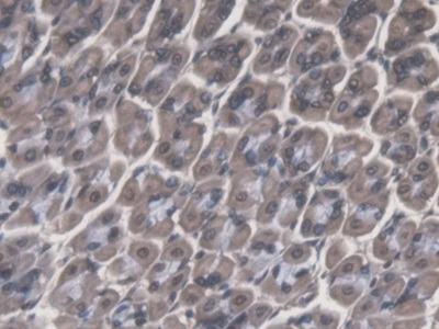 Cathepsin F Antibody in Immunohistochemistry (Paraffin) (IHC (P))
