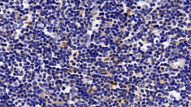 STAT5a Antibody in Immunohistochemistry (Paraffin) (IHC (P))