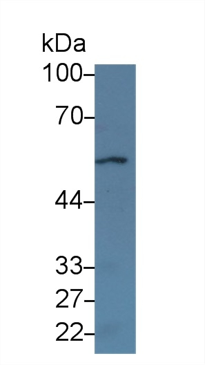 CHRNA2 Antibody in Western Blot (WB)
