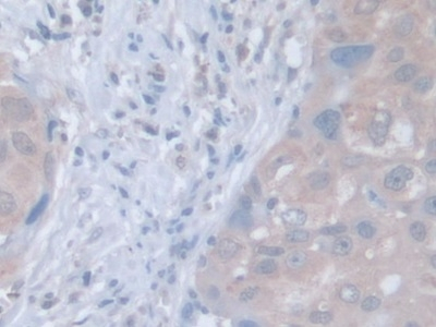 LDOC1 Antibody in Immunohistochemistry (Paraffin) (IHC (P))