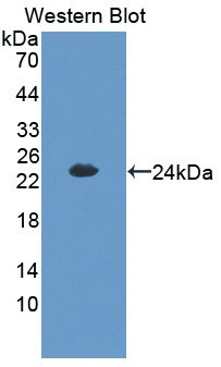 CITED1 Antibody in Western Blot (WB)