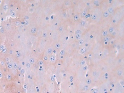 GMFG Antibody in Immunohistochemistry (Paraffin) (IHC (P))